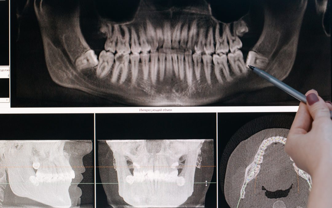 Chirurgia dentale guidata computerizzata