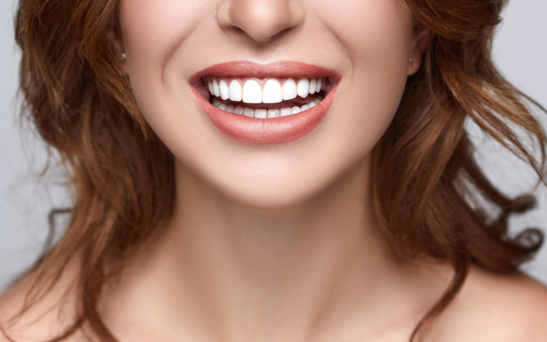 Sbiancamento dentale, ecco tutti i segreti per il tuo miglior sorriso